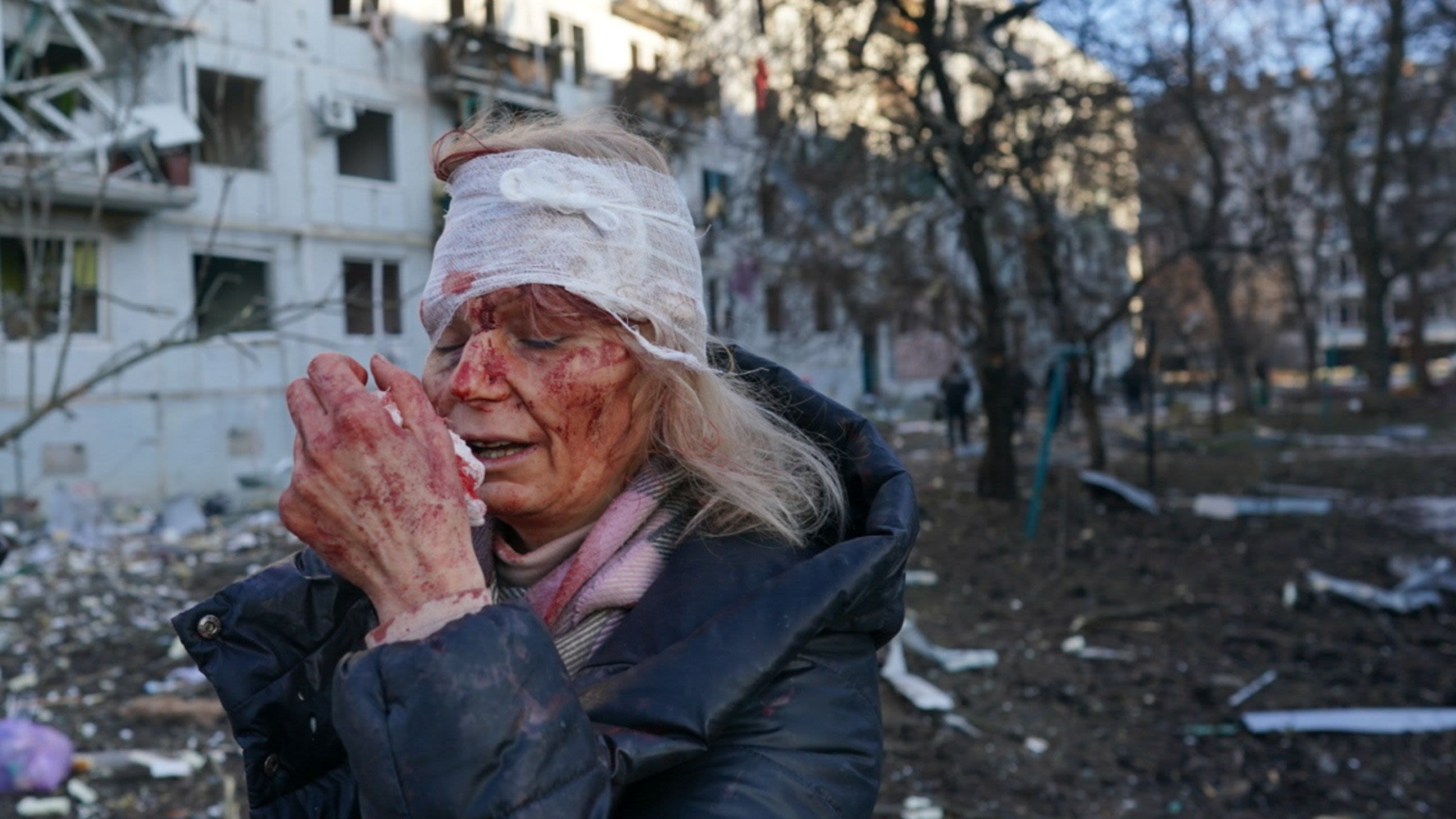 An old woman with a bloody face and bandages wrapped around her head stands in front of a bombed-out building.