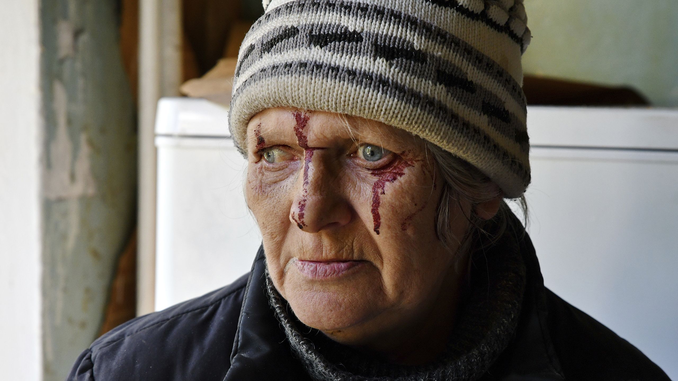 Une femme avec des taches de sang sur le visage, regardant au loin (© Andriy Andriyenko/AP Photo)
