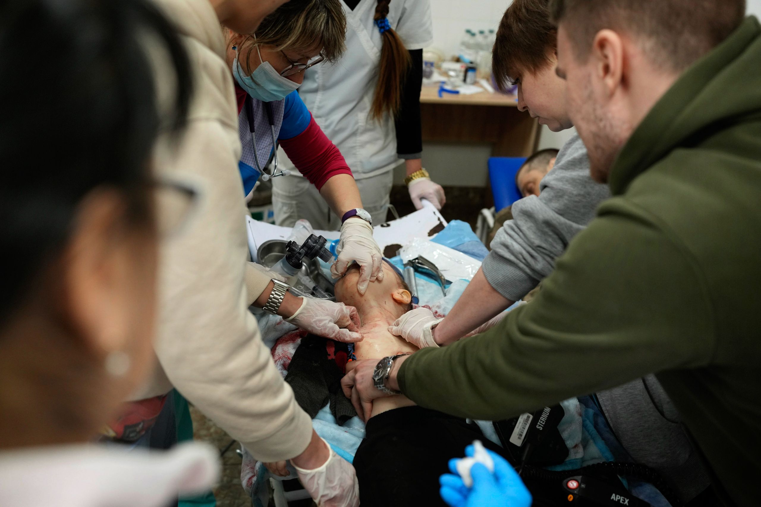 Medical workers desperately try to save Kirill's life. (© Evgeniy Maloletka/AP Images)